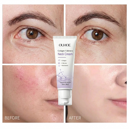 💥80K+ SOLD💕 Collagen Fullerene Neck Cream | Lift Saggy Neck & Erase Neck Lines -Viral