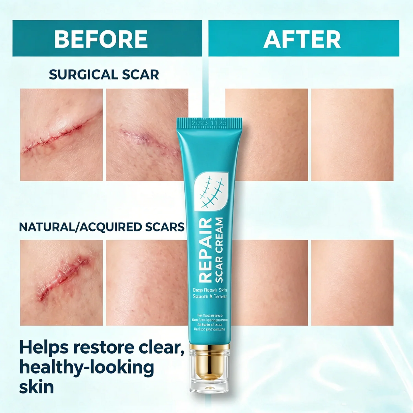 🩹 Long-lasting Scar Care Cream, Ideal for Daily Skin Repair -Viral